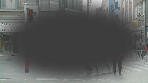 représentation d'une DMLA avancée
